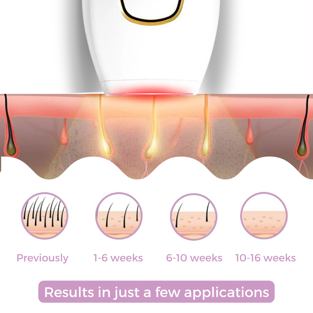 Wisdom and Co® IPL Hair Removal! The leading Laser Hair Remover for your Home
