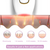 Wisdom and Co® IPL Hair Removal! The leading Laser Hair Remover for your Home