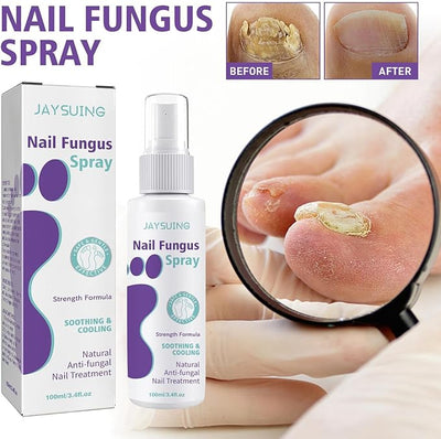 Gentle Nail Fungus Remover